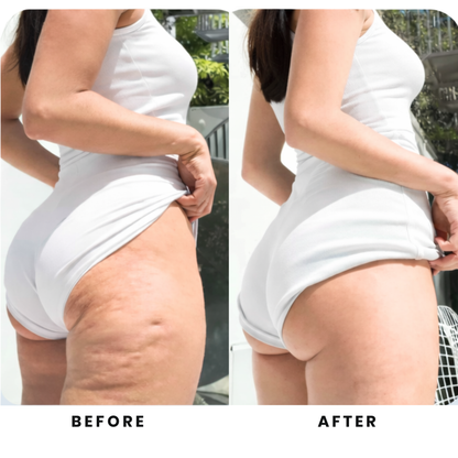 Velora Sculpt & Glow – Firmer Skin, Less Cellulite